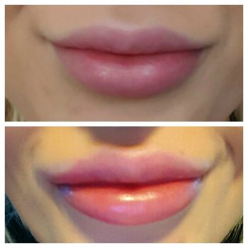 lips1
