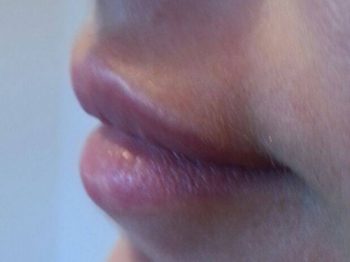 lips15