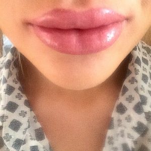 lips21