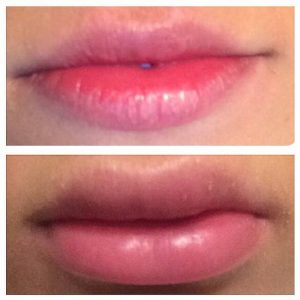 lips22