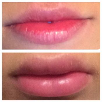 lips22